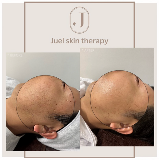 [Juel Skin Therapy] Facial/Skin Care and Therapy in Chungdam, Seoul