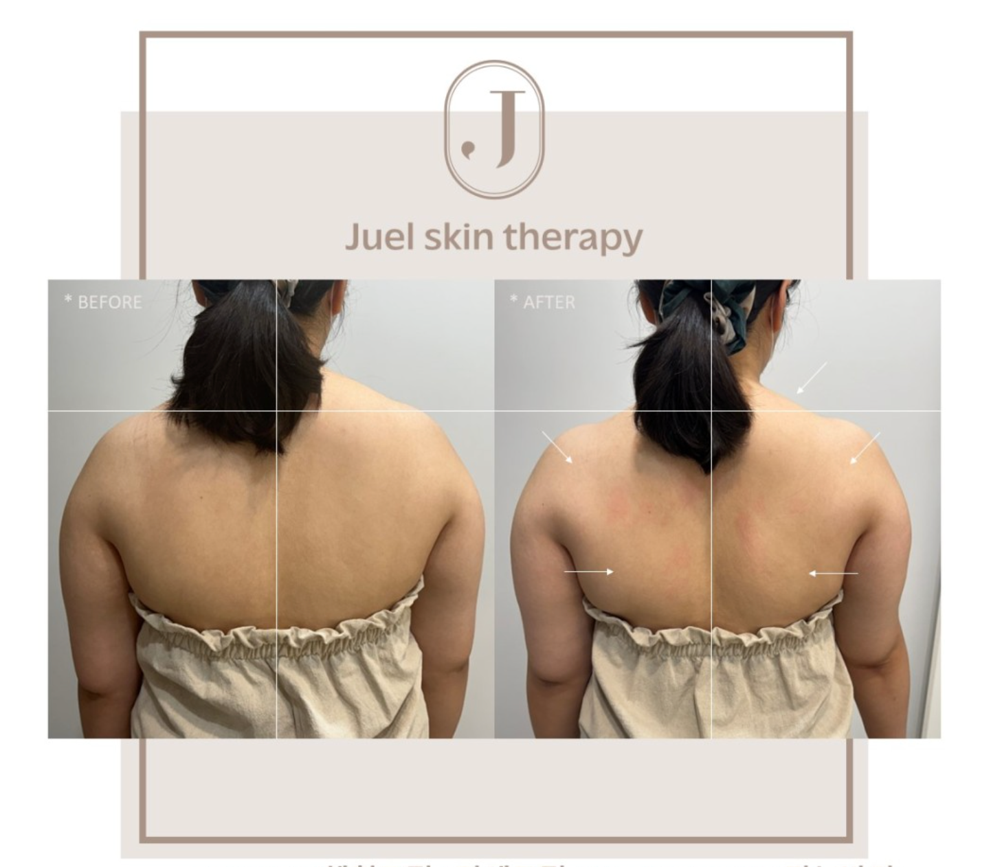 juel-skin-therapy-product-thumbnail-4